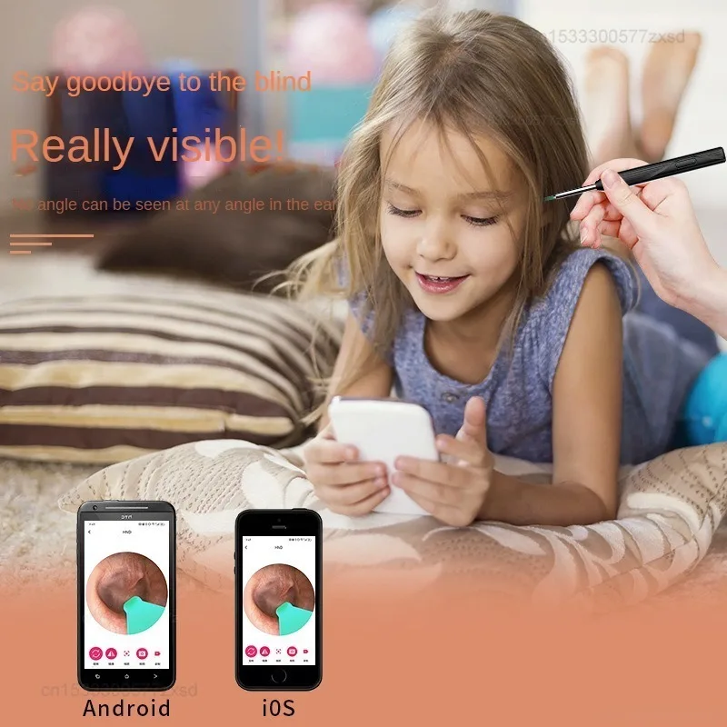 Smart Visual Ear Sticks Otoscope Ear Cleaner High Precision Ear Wax Removal Tool Mini Camera Removal Health Care Tools - Image 2